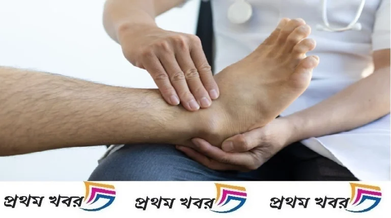 guillain-barre-syndrome